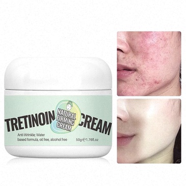 Tretinoina